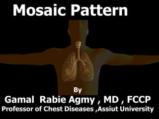 Mosaic Patternitie
By
Gamal Rabie Agmy , MD , FCCP
Professor of Chest Diseases ,Assiut University
 