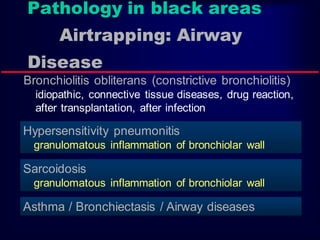 Pathology in black areas
Airtrapping: Airway
Disease
Bronchiolitis obliterans (constrictive bronchiolitis)
idiopathic, connective tissue diseases, drug reaction,
after transplantation, after infection
Hypersensitivity pneumonitis
granulomatous inflammation of bronchiolar wall
Sarcoidosis
granulomatous inflammation of bronchiolar wall
Asthma / Bronchiectasis / Airway diseases
 