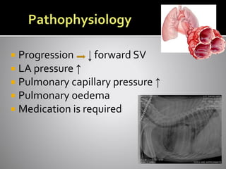  Progression forward SV
 LA pressure ↑
 Pulmonary capillary pressure ↑
 Pulmonary oedema
 Medication is required
 