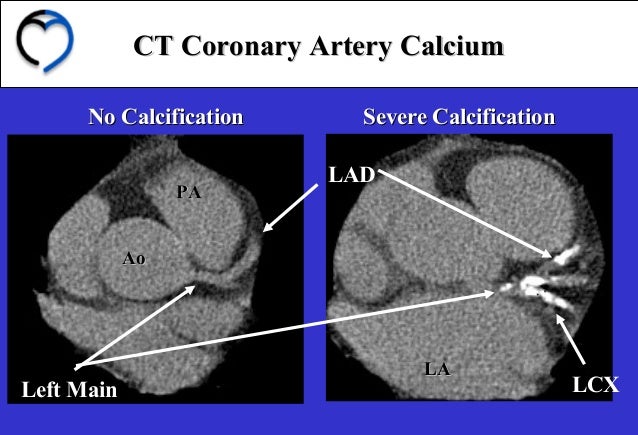 214 how can calcium score improve your practice