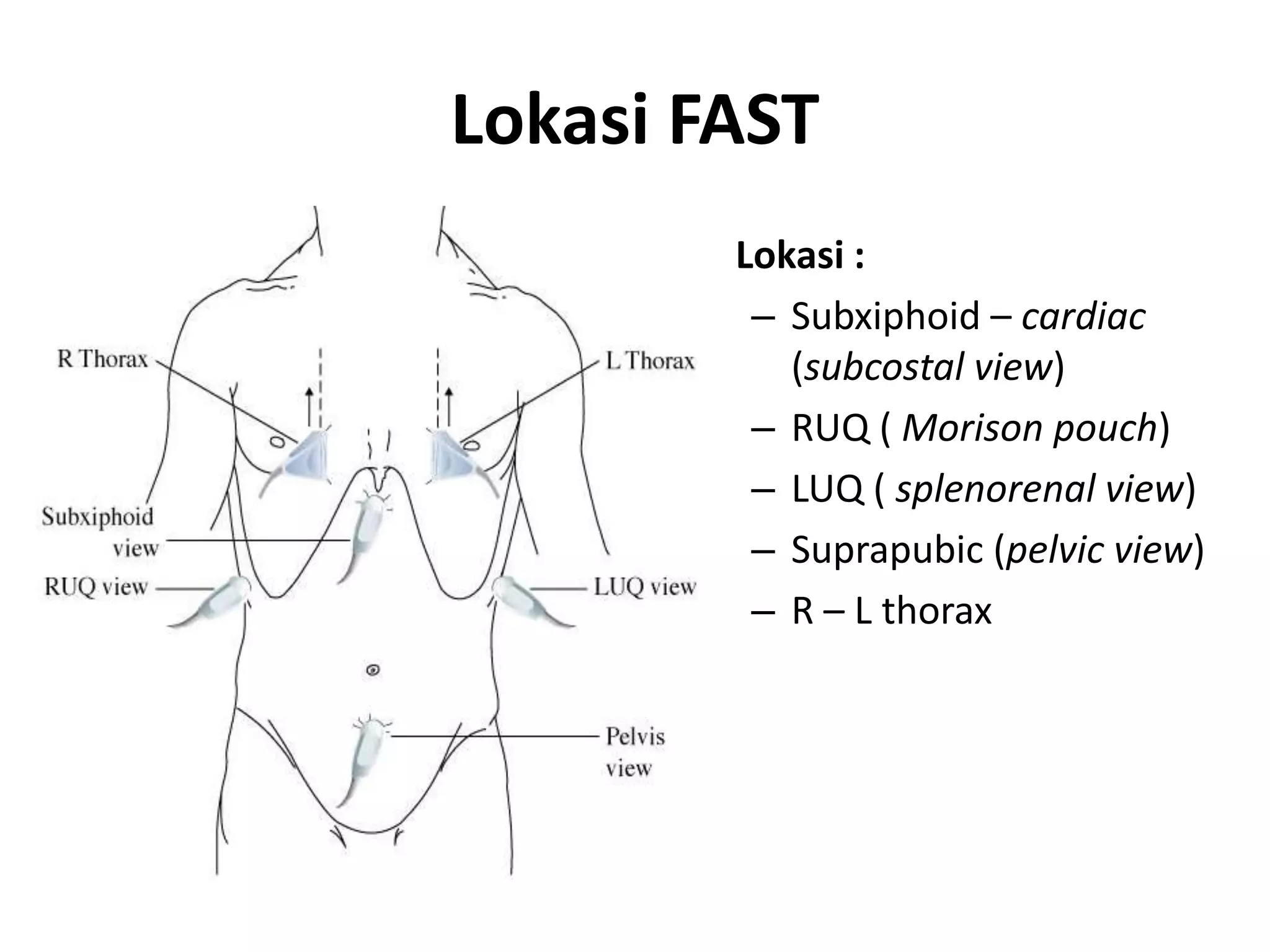 FAST (Focused Assessment Sonography for Trauma) | PPTX