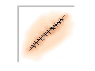 Teaching English Conversation