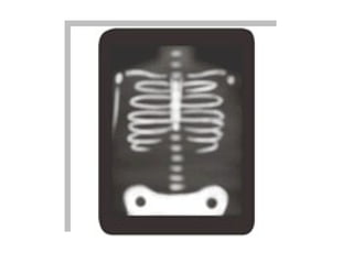 Teaching English Conversation