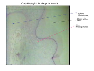 Células
Cartilaginosas
Células
Mesenquimaticas
Células Epiteliales
planas
Corte histológico de falange de embrión
 