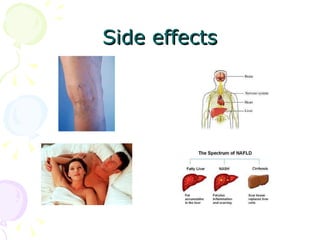 Side effects 