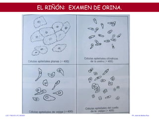 EL RIÑÓN:  EXAMEN DE ORINA. <ul><li>  </li></ul>LDC1.TM2.IES JFC 95/2007  Pfr .  José de Medina Ruiz. 