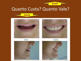 Quanto Custa? Quanto Vale?
POUCO
MUITO
 
