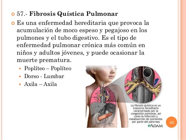 El sida es curable isaac goiz pdf converter 2016