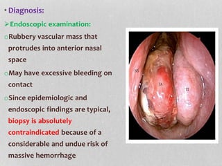 • Diagnosis:
Endoscopic examination:
oRubbery vascular mass that
protrudes into anterior nasal
space
oMay have excessive bleeding on
contact
oSince epidemiologic and
endoscopic findings are typical,
biopsy is absolutely
contraindicated because of a
considerable and undue risk of
massive hemorrhage
 