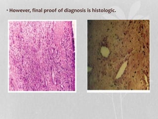 • However, final proof of diagnosis is histologic.
 