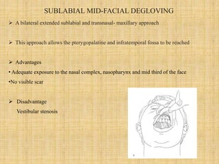 Sublabial Excision Jna(juvenile nasopharyngeal angiofibroma) current treatment modalities ...