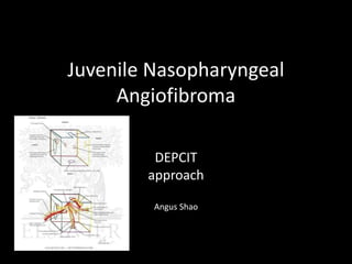 Juvenile Nasopharyngeal
Angiofibroma
DEPCIT
approach
Angus Shao
 