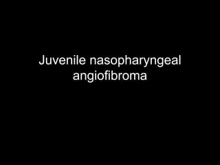 Juvenile nasopharyngeal
angiofibroma
 