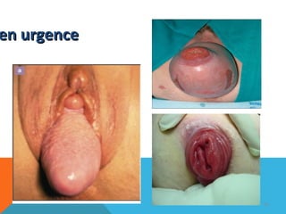 eenn uurrggeennccee 
90 
 