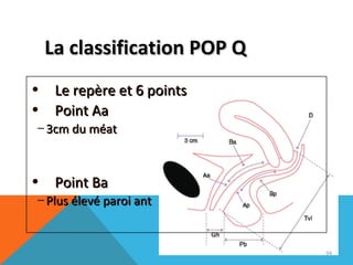 LLaa ccllaassssiiffiiccaattiioonn PPOOPP QQ 
• LLee rreeppèèrree eett 66 ppooiinnttss 
• PPooiinntt AAaa 
– 33ccmm dduu mmééaatt 
• PPooiinntt BBaa 
– PPlluuss éélleevvéé ppaarrooii aanntt 
94 
 