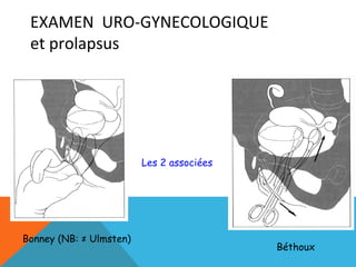EXAMEN URO-GYNECOLOGIQUE 
et prolapsus 
Bonney (NB: ≠ Ulmsten) 
Béthoux 
Les 2 associées 
 