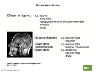 Sites and causes of coma.
David E Bateman J Neurol Neurosurg Psychiatry
2001;71:i13-i17
©2001 by BMJ Publishing Group Ltd
 