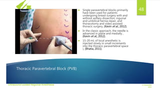 Ultrasound Guided Regional Anesthesia | PPSX