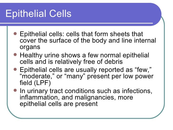 Urinalysis 3/27