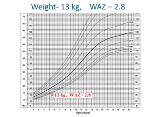 Weight- 13 kg, WAZ – 2.8
 