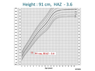 Height : 91 cm, HAZ - 3.6
 