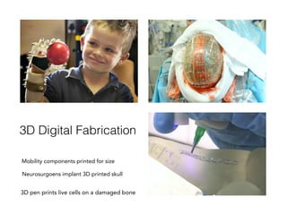 3D pen prints live cells on a damaged bone
Neurosurgoens implant 3D printed skull
3D Digital Fabrication!
Mobility components printed for size
 
