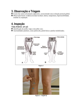 3. Observação e Triagem
  Exame das outras articulações adjacentes, acrescentando uma avaliação postural global;
  Observação Geral: evidência de dano tecidual, edema, temperatura, hipersensibilidade,
  estalido ou crepitação.



4. Inspeção
Vista Anterior, em pé:
  identificação de joelho valgo e de joelho varo;
  Anormalidades patelares, como patela alta, patela baixa e patelas medializadas;




                                         Figura 1




                                   Figura 2 - Ângulo Q
 
