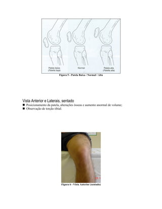 Figura 5 - Patela Baixa / Normal / Alta




Vista Anterior e Laterais, sentado
  Posicionamento da patela, alterações ósseas e aumento anormal de volume;
  Observação de torção tibial.




                            Figura 6 - Vista Anterior (sentado)
 