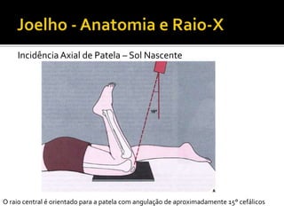 Incidência Axial de Patela – Sol Nascente
O raio central é orientado para a patela com angulação de aproximadamente 15° cefálicos
 
