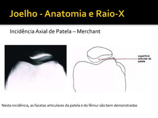 IncidênciaAxial de Patela – Merchant
Nesta incidência, as facetas articulares da patela e do fêmur são bem demonstradas
 