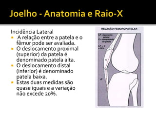Incidência Lateral
 A relação entre a patela e o
fêmur pode ser avaliada.
 O deslocamento proximal
(superior) da patela é
denominado patela alta.
 O deslocamento distal
(inferior) é denominado
patela baixa.
 Estas duas medidas são
quase iguais e a variação
não excede 20%.
 