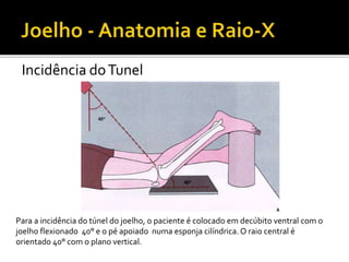 Incidência doTunel
Para a incidência do túnel do joelho, o paciente é colocado em decúbito ventral com o
joelho flexionado 40° e o pé apoiado numa esponja cilíndrica.O raio central é
orientado 40° com o plano vertical.
 