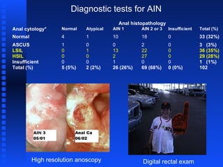Anal dysplasia: Diagnosis and Management, OR Everything you ever wanted ...
