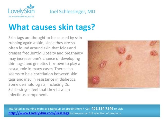 Joel Schlessinger MD F...