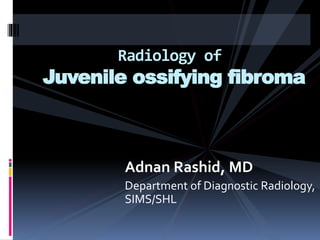 Adnan Rashid, MD
Department of Diagnostic Radiology,
SIMS/SHL
Radiology of
Juvenile ossifying fibroma
 