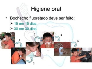Higiene oral Bochecho fluoretado deve ser feito: 15 em 15 dias 30 em 30 dias 1 2 3 4 5 