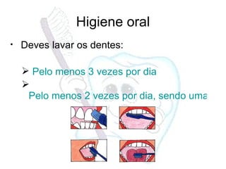 Higiene oral Deves lavar os dentes: Pelo menos 3 vezes por dia Pelo menos 2 vezes por dia, sendo uma antes de ir para a cama 