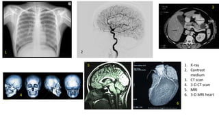 1. X-ray
2. Contrast
medium
3. CT scan
4. 3-D CT scan
5. MRI
6. 3-D MRI heart
1
4
5
6
3
2
 