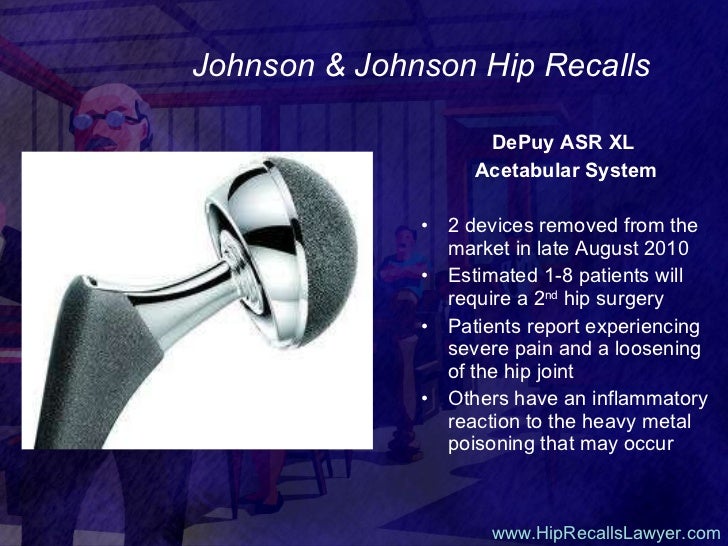 Johnson and Johnson Hip Recall Lawyer