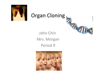 Organ Cloning John Chin  Mrs. Morgan Period 9 