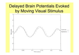Delayed Brain Potentials Evoked
   by Moving Visual Stimulus
 