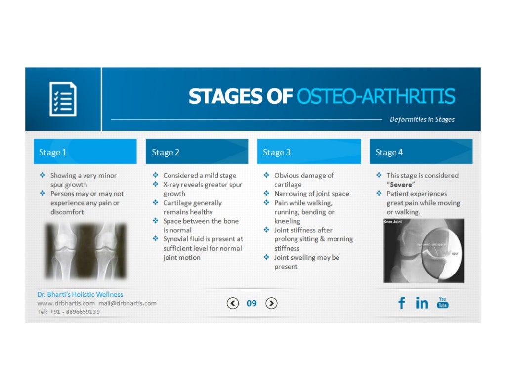 OsteoArthritis Information Booklet