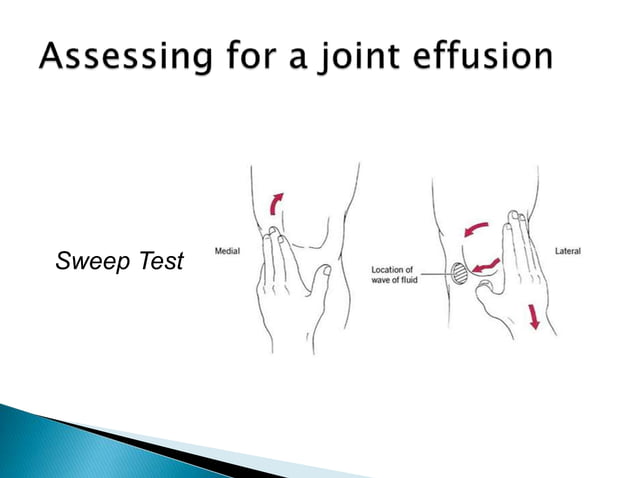 Sweep Testing Joint Aspiration and Injection Techniques Powerpoint | PPTX