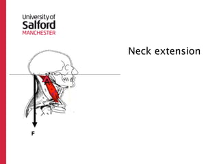 Neck extension
First Class
     A


         R



 F
 