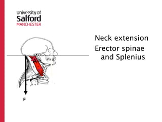 Neck extension
First Class   Erector spinae
                and Splenius
     A


         R



 F
 