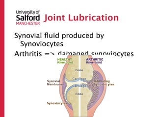 Joint Lubrication
Synovial ﬂuid produced by
  Synoviocytes
Arthritis => damaged synoviocytes
 