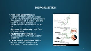 Comprehensive Overview of Joint, Connective Tissue, and Bone Disorders ...