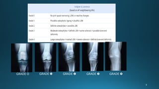 Comprehensive Overview of Joint, Connective Tissue, and Bone Disorders ...