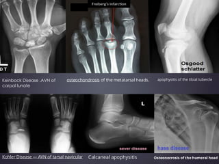 Comprehensive Imaging Techniques and Radiological Findings in Joint ...