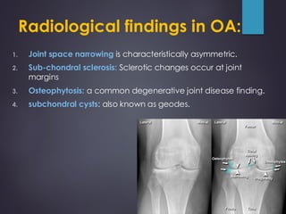 Comprehensive Imaging Techniques and Radiological Findings in Joint ...